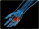 As the most frequent physical injury, hand injury  accounts for 6.6% to 2.9% of all physical injuries.